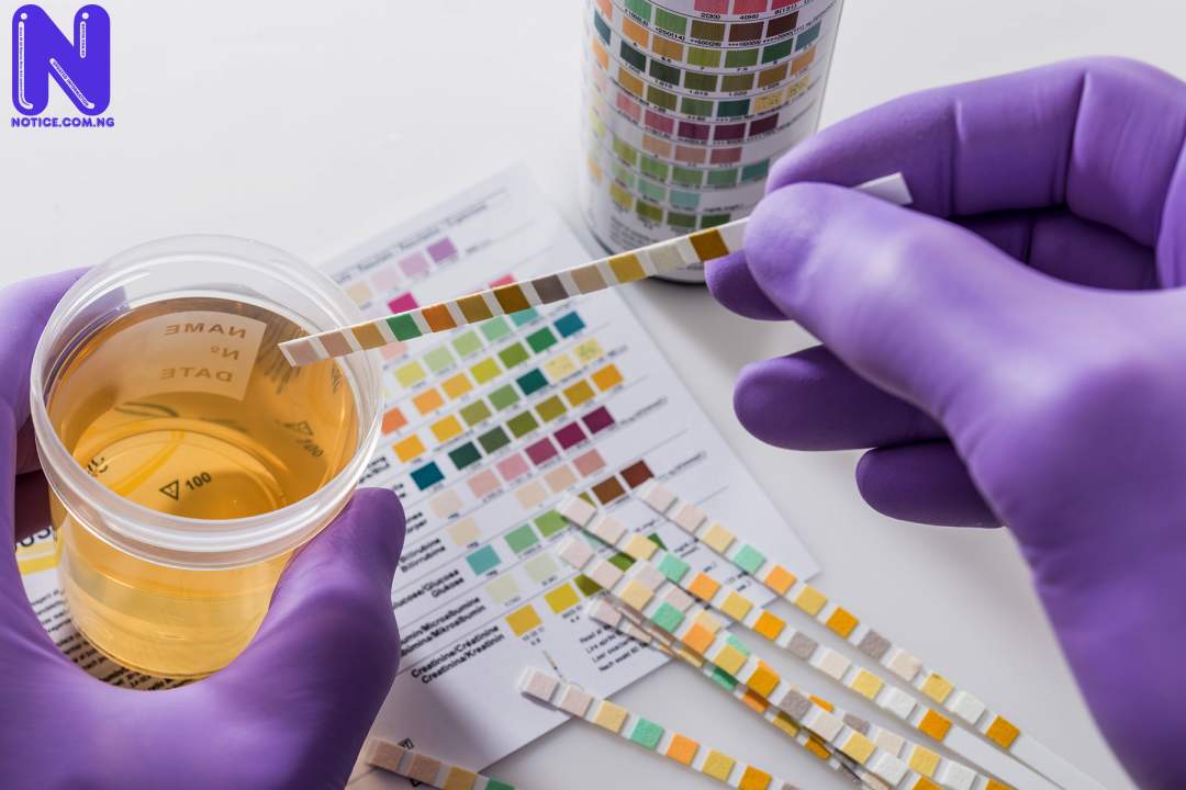 1800X1200 DRUGS FALSE POSITIVE TEST