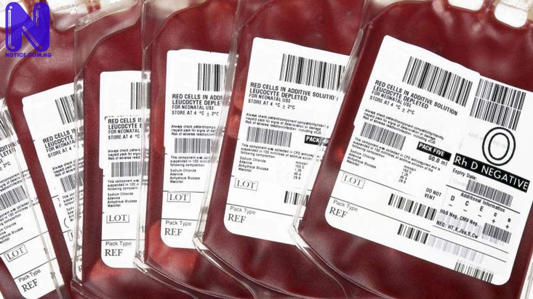  Shortage of blood hits Plateau hospitals - Killings BLOOD180728