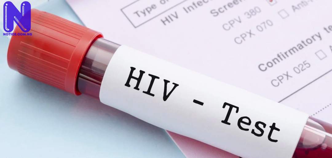 HIV-TEST