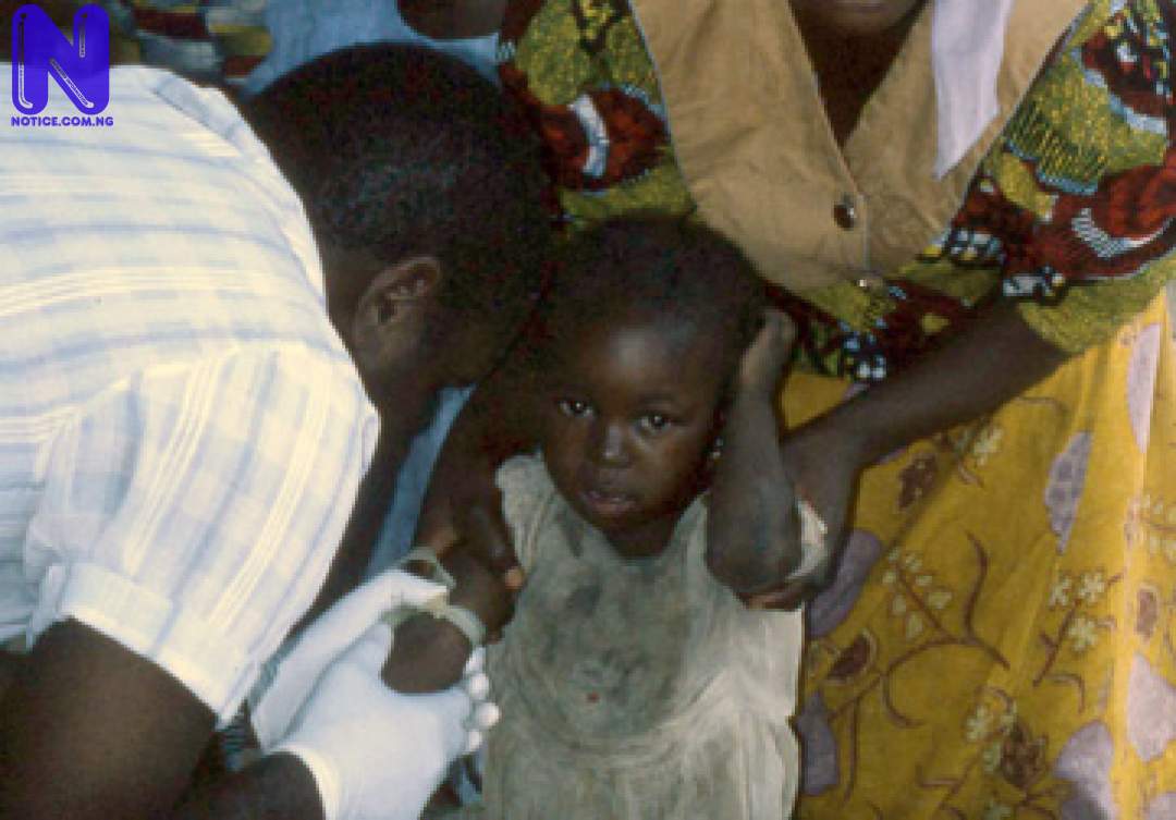 LASSA FEVER