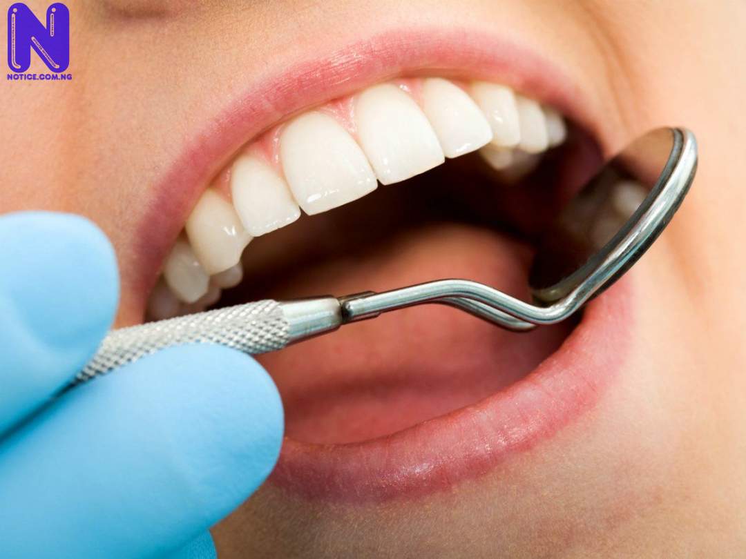 Here’s why 7 in 10 Nigerian People live with tooth decay TOOTH107274
